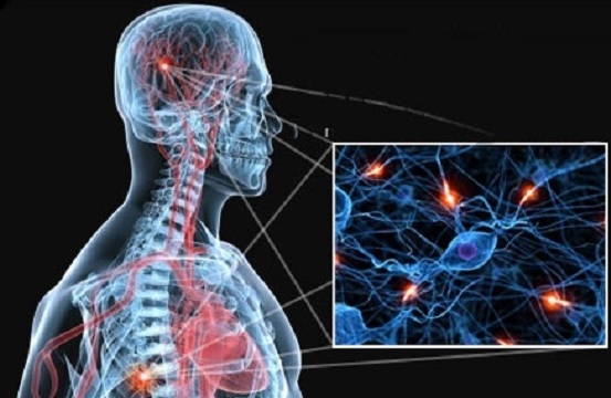 Signos precoces de esclerosis múltiple