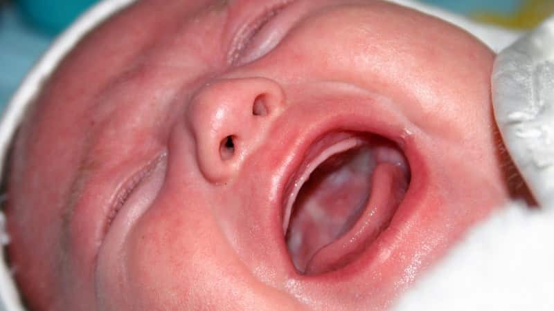 Candida dråper for nyfødte for oral