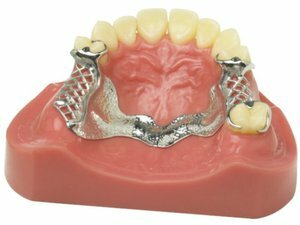 Postup z výrobní částečné zubní protézy