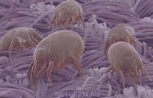 En el polvo, micro-saprophytes