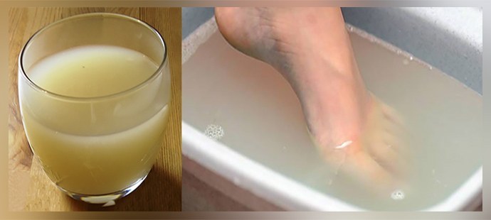 Euforbia de hongos en las uñas, pies: recetas efectivas, reseñas