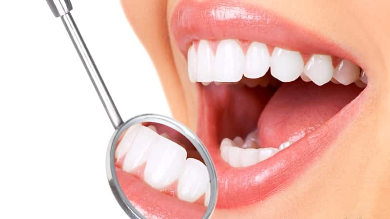 Anpassningen av tänderna hemma
