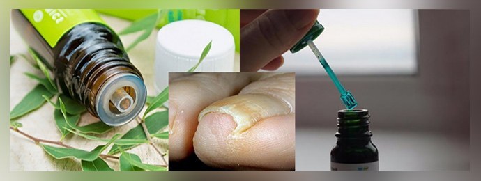 Zelenka de hongos en las uñas: revisiones, tratamiento.