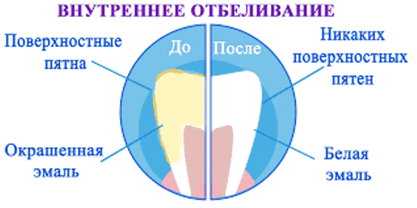 Weiß-Streifen-Kamm Whites Zähne Bewertungen