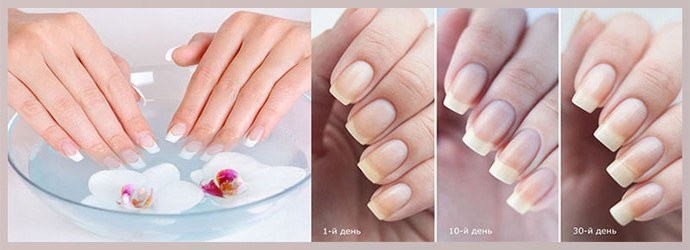 Hongo de las uñas en las manos después de la extensión de las uñas: las principales causas de infección.