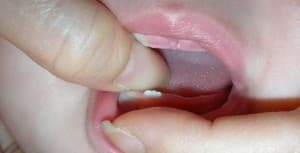 Når de første tænder vises i børn: rækkefølgen og timingen af ​​udbrud