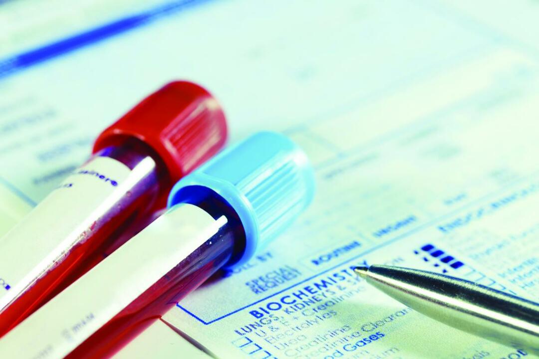 marcador tumoral CA 125: norma de descodificação e os resultados dos testes do sangue