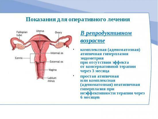 lobulär hyperplasi av endometrium lechenie5