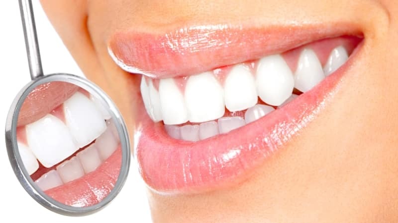 Bleichen der Zähne in der Heimat Wasserstoffperoxid