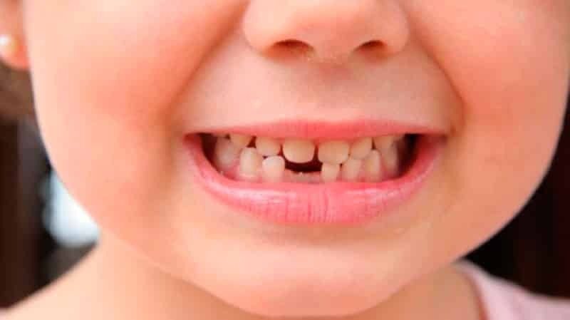 I hvilken alder er ved at ændre tænder hos børn