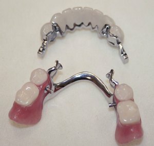 Karakteristisk beskrivelse af lås dental strukturer