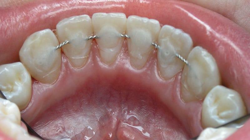 Tandköttsproblem: behandling, symtom, bilder