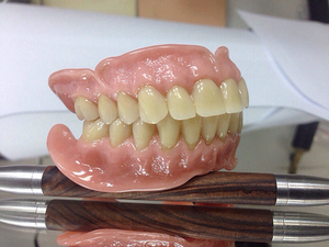 Acry-Free removable dentures - benefits
