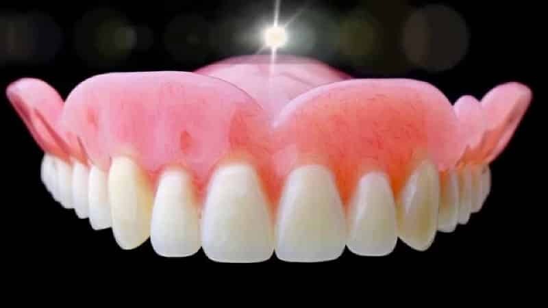 Pehmeä hammasproteesit: valokuvat, arvostelut asiantuntijoiden