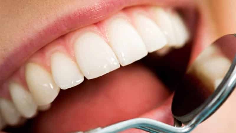 Hur man behandlar fickan i tandköttet mellan tänderna: photo