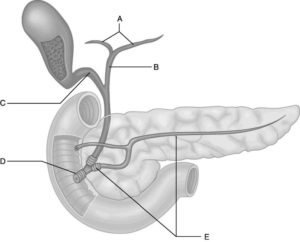 Pancreaskanalen