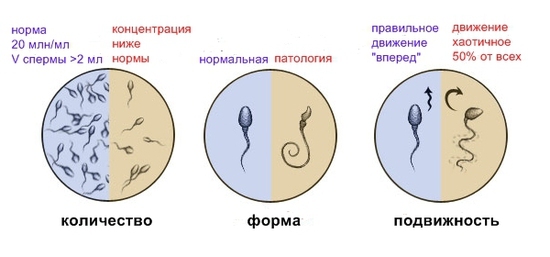 Morfologische kenmerken van spermatozoa