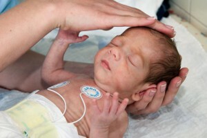 Patologija središnjeg živčanog sustava kod novorođenčadi