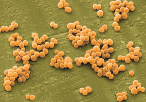 Staphylococcus aureus - el tipo más peligroso de estafilococos