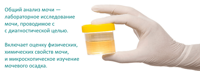 zbirka urina