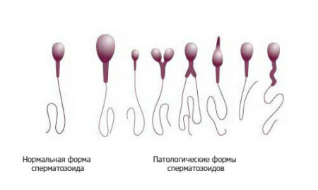 Formy-spermie