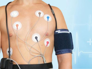 Holter ECG-bewaking