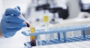 Chronische pancreatitis: oorzaken, symptomen, behandeling en aanbevolen dieet