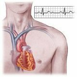 Bradycardia, symptoms and treatment