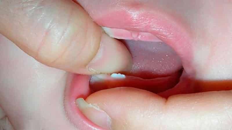 Os primeiros dentes em crianças