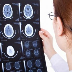 Cyste van de hersenen: beschrijving, symptomen en behandeling