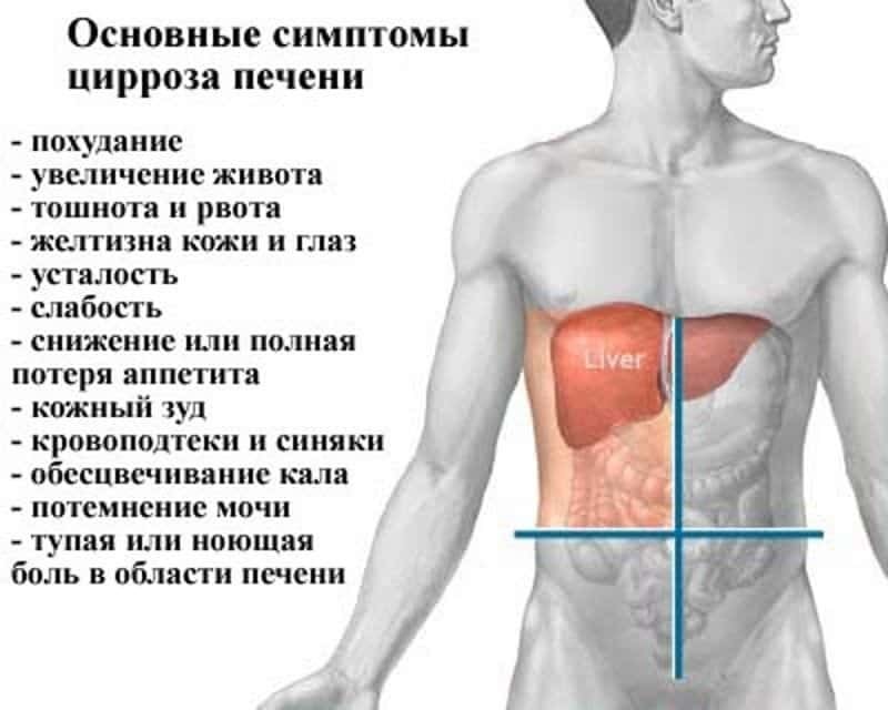 Symptoms of liver cirrhosis in men at different stages of