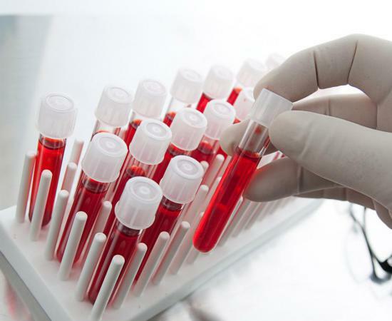 Beim Decodieren des Bluttest wird durch die Höhe der weißen Blutkörperchen bestimmt