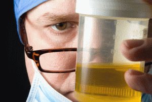 Analyses voor pancreatitis: wat moeten de indicatoren zijn?