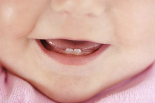 teething-tanden-in-kinderen1