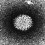 Papillomavirus: kliniek, diagnose, behandeling