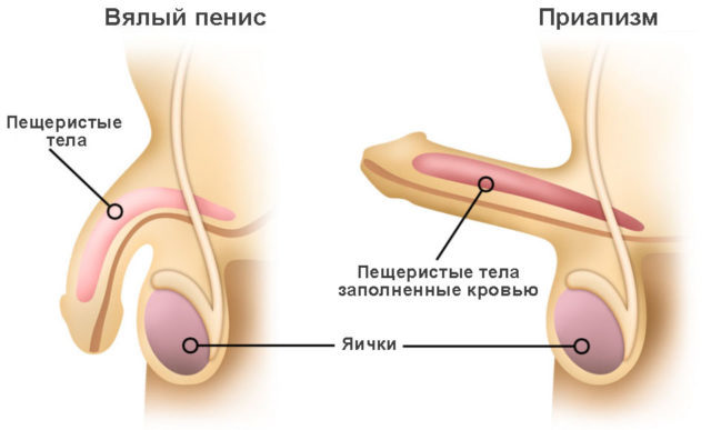 Varför smärta uppstår i penis
