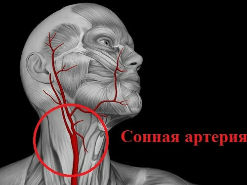 sonnaya Arteria