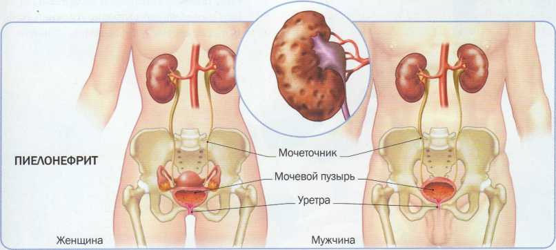 Treatment of kidneys at home
