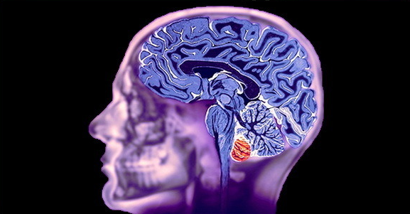 Indicaties voor MRI gedrag