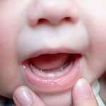 Zob pri otrocih
