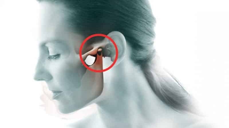 Pourquoi mâchoire endolorie à l'oreille, et ce qu'il faut faire