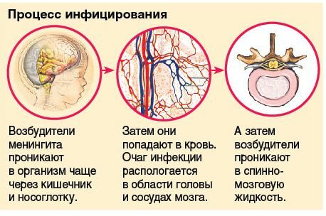 Meningitis Scheme
