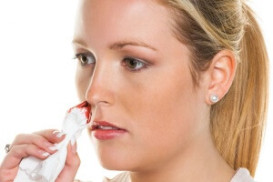 Factores que causan hemorragias nasales frecuentes