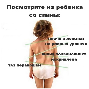 How to check if the child has scoliosis or not