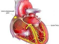 sydän- ja verisuonisairaus