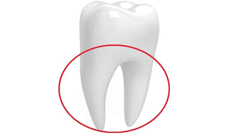 How to insert teeth if there is no root