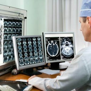 postopek MRI možganov možgani