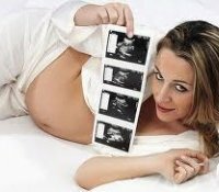 Röntgenstrahlen während der Schwangerschaft