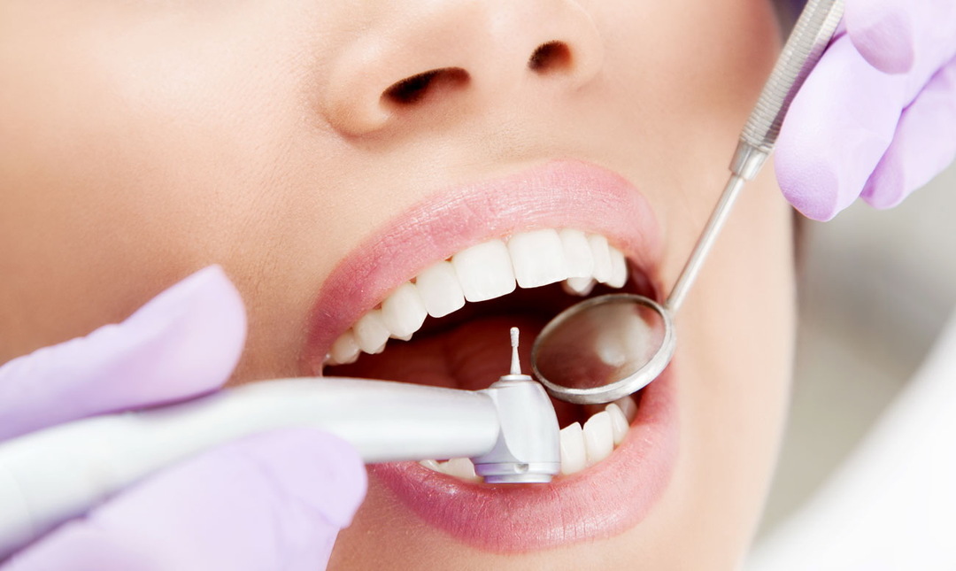 Caries: types, treatment, prevention