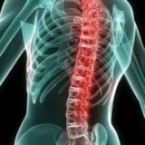 Surgical intervention in the treatment of the spine